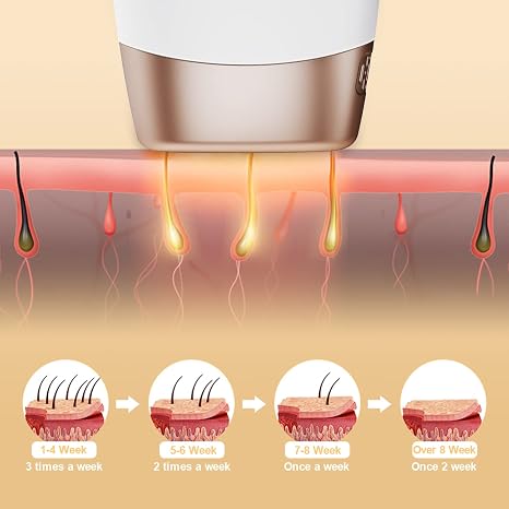 NINE-GEAR IPL ENERGY EFFICIENT HAIR REMOVAL 9 STAGES