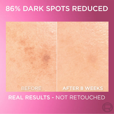 L'oreal Glycolic Bright Face Serum 30ml