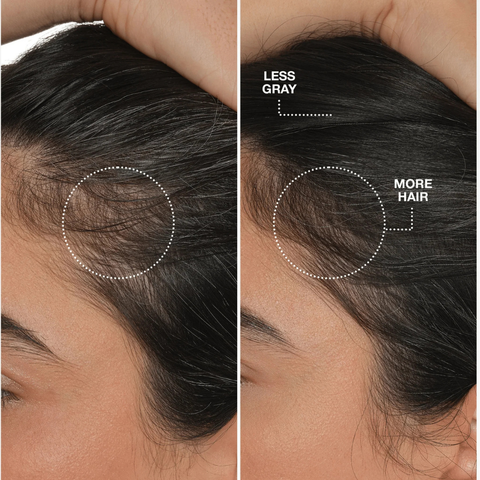 Before and after scalp results showing less gray and more hair with K18 FutureIQ