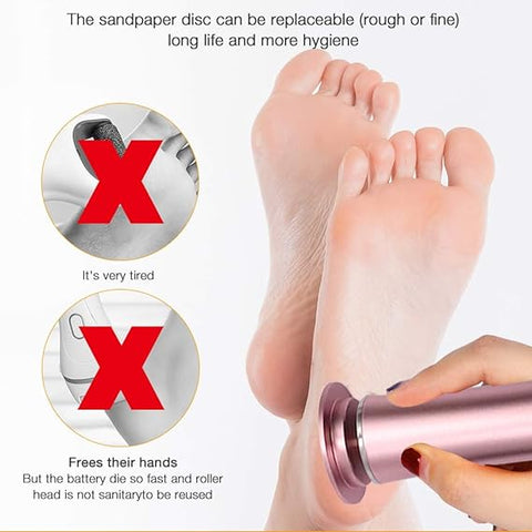 Electric Foot Callus Remover