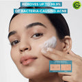Garnier Fast Clear Daily Exfoliating Wash 150ml, image 3
