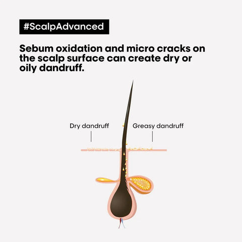 L'Oreal Professionnel Scalp Advanced Anti Discomfort Dermo Regulator Shampoo 300ml, image 5
