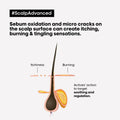 L'Oreal Professionnel Scalp Advanced Anti Discomfort Intense Soother Treatment 200ml, image 6