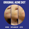 Sephora Salicylic Acid Day and Night Acne Duo by Peace Out, image 3