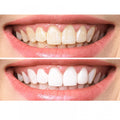 Stella White Coco Charcoal Teeth Whitening Powder, image 2