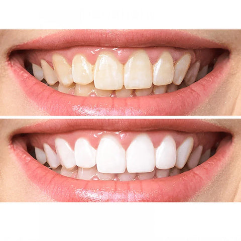 Stella White Coco Charcoal Teeth Whitening Powder, image 2