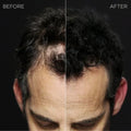 Toppik Hair Building Fibers, image 4