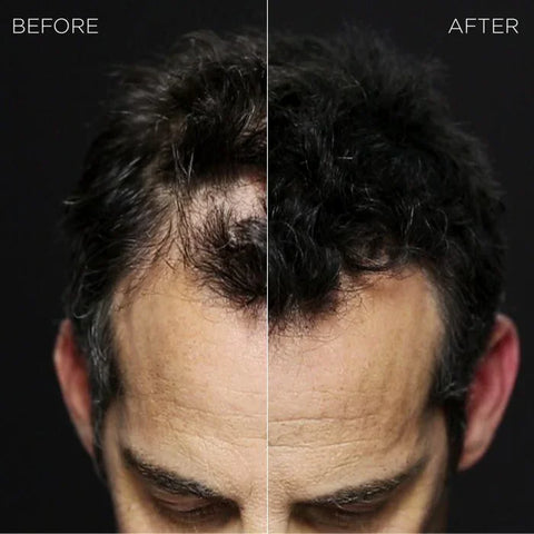 Toppik Hair Building Fibers, image 4